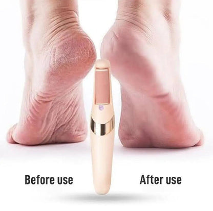 Electric Foot Callus Remover – Pedicure File for Cracked Heels